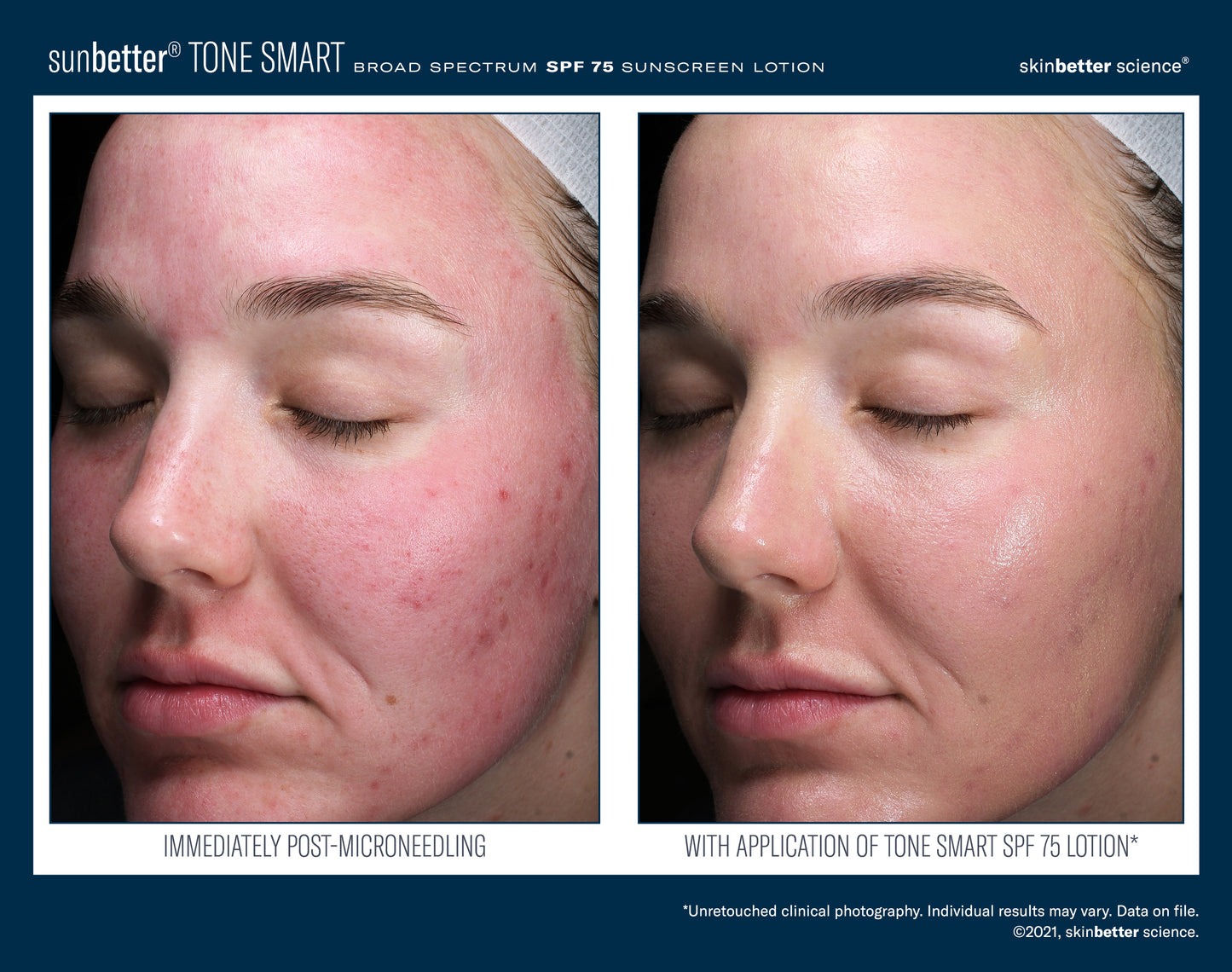 sunbetter TONE SMART SPF 75 Lotion 50ml
