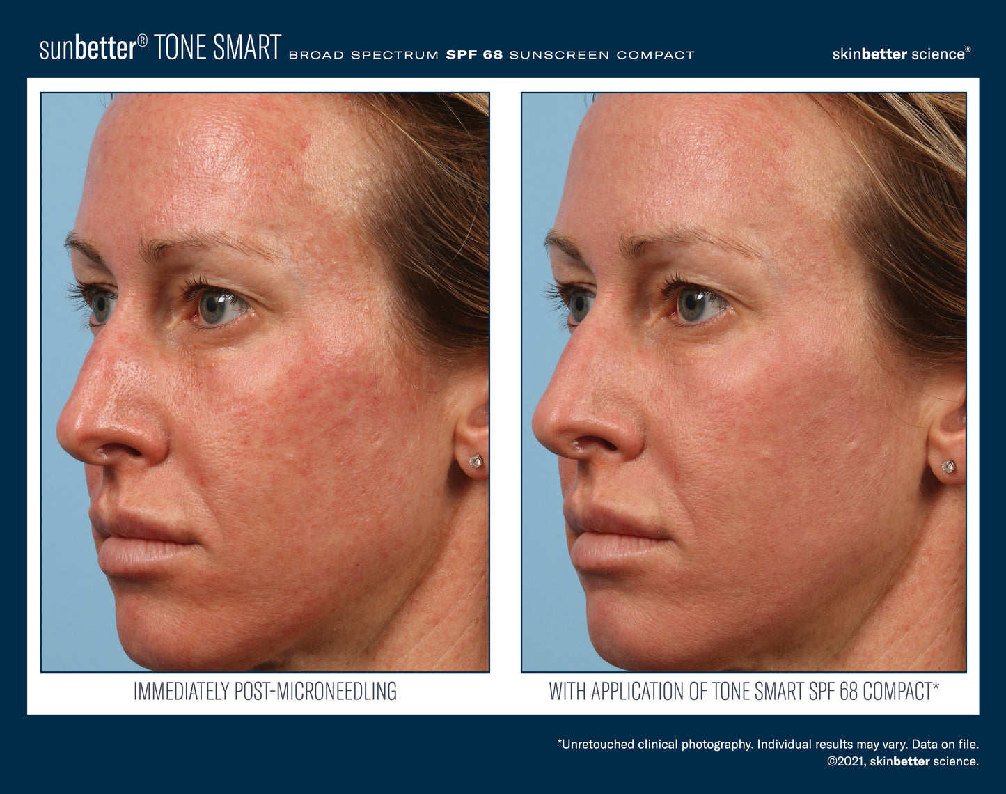 sunbetter TONE SMART SPF 68 Compact